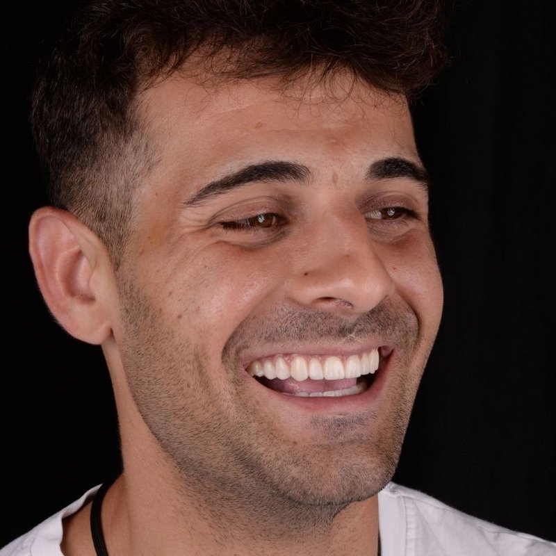 Implantes Dentales Barcelona